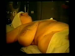 Russian huge tits macromastia